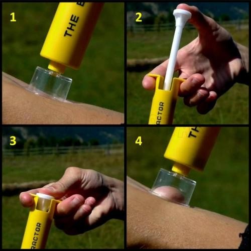 Kit anti-morsure Sawyer Bite & Sting Kit